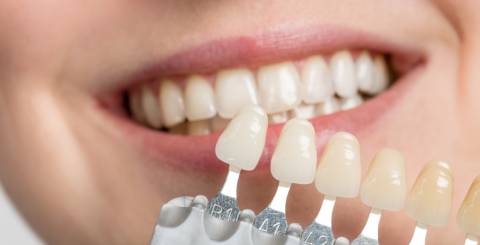 7 Questions to Ask Your Dentist Before Getting Veneers 7 Questions to Ask Your Dentist Before Getting Veneers